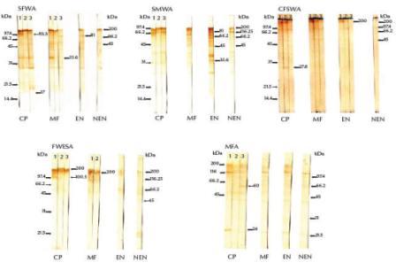 Figure 2 Western blots showing immunogenic bands of prepared antigens recognized by high (lane 1), moderate (lane 2) and weak (lane 3) IgG reactivity in human sera (CP = chronic amicrofilaraemic patients, MFA = microfilaraemic asymptomatic subjects, EN = normal subjects from endemic area, NEN = normal controls from nonendemic area). Both low (left) and high (right) molecular weight markers were included