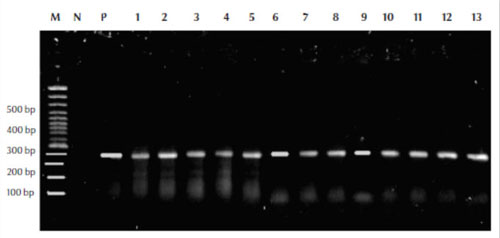 Figure 1 Polymerase chain reaction assay results using the MF and MR primers for  detection and amplification of the Mycobacterium rpoB gene from the isolates  with leader marker (100 bp) to detect the size of amplified DNA  M = molecular weight control marker (100 bp); P = positive control; N = negative  control; lanes 1–13 from patient samples
