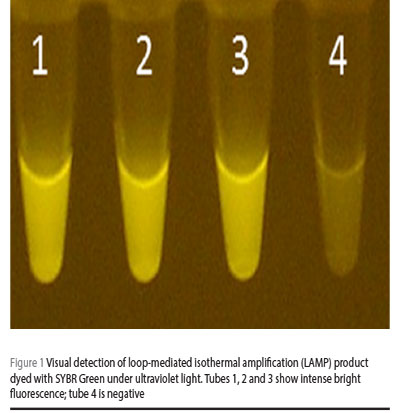Figure 1 Visual detection of loop-mediated isothermal amplification (LAMP) product dyed with SYBR Green under ultraviolet light. Tubes 1, 2 and 3 show intense bright fluorescence; tube 4 is negative