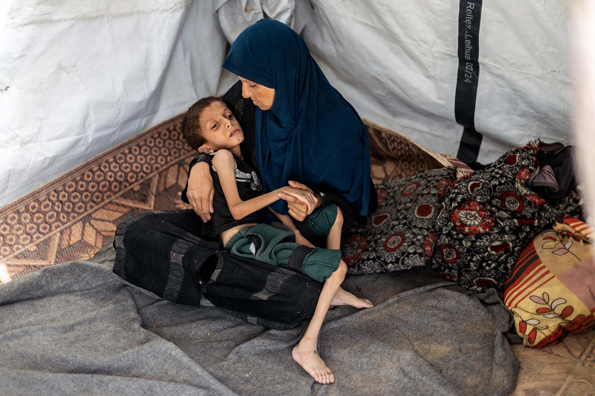 A child suffering from malnutrition sets in a tent with his mother. Photo credit: WHO
 