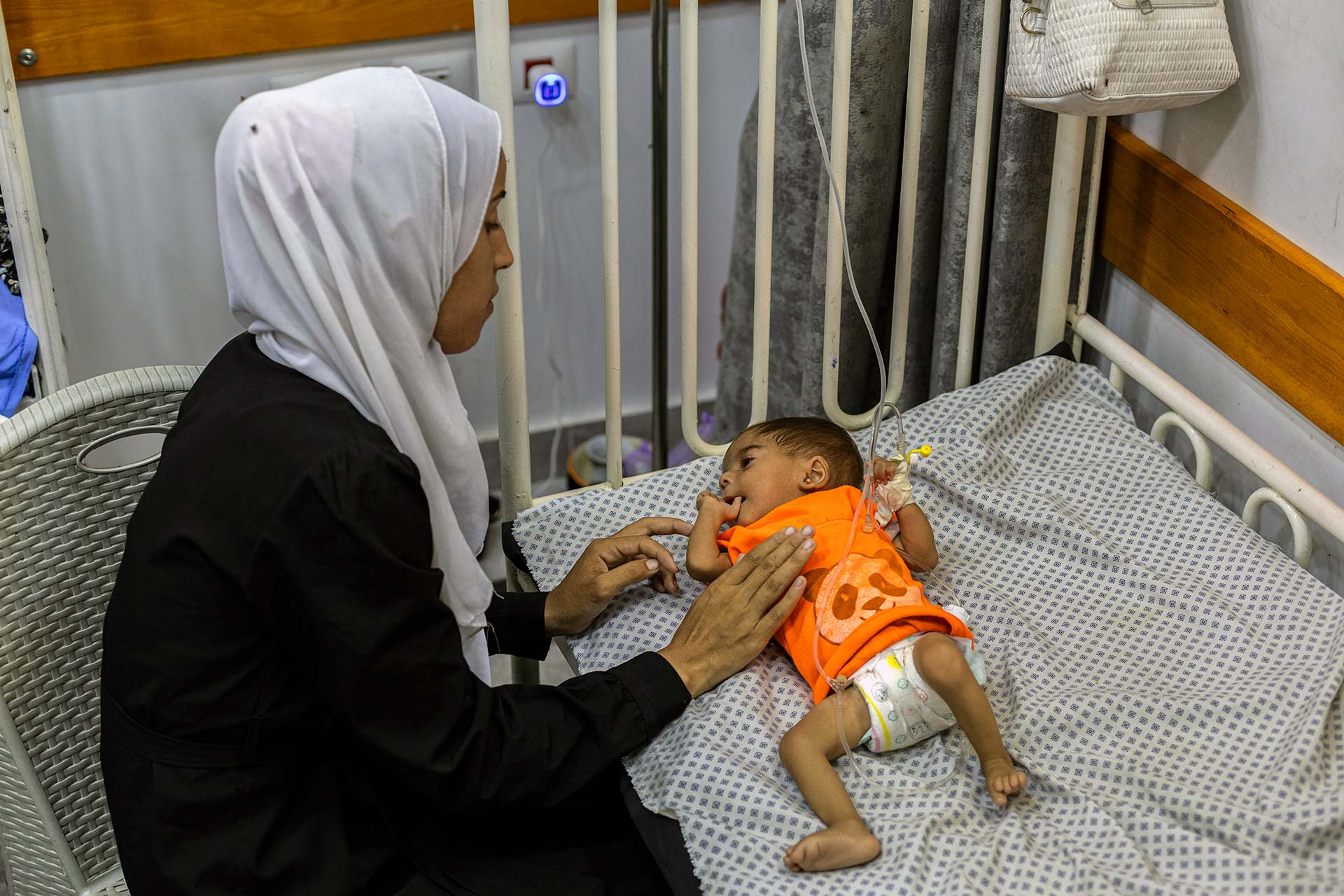 A child with severe acute malnutrition (SAM) admitted to the inpatient SAM stabilization unit at Patient Friends Association Hospital. Photo credit: WHO