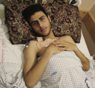 Mohamed_a_16-year-old_athlete_receives_an_above-knee_amputation
