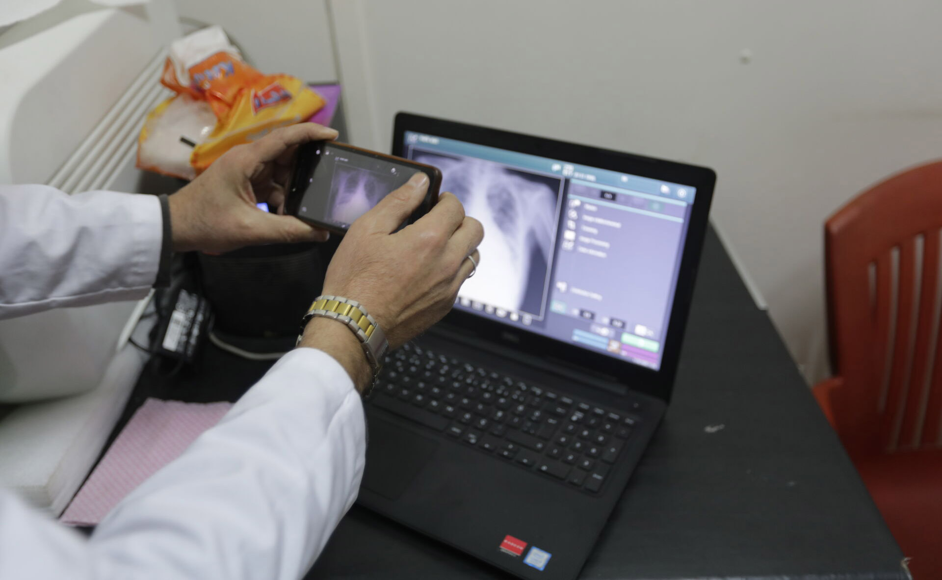 A person wearing a white coat uses a smartphone to photograph a chest X‑ray displayed on a laptop screen on a desk with medical items nearby