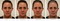 L'affiche est composée de quatre photos de visages de la même femme prénommée Coleen, aujourd'hui et dans 5, 10 et 20 ans. Son visage est marqué de plus en plus de rides et de cernes à mesure que les années passent.