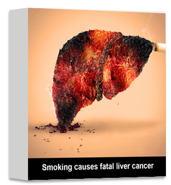 Fumer provoque le cancer mortel du foie