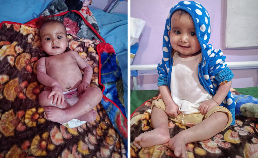 Baby Jihad makes a full recovery in two weeks in Hajjah