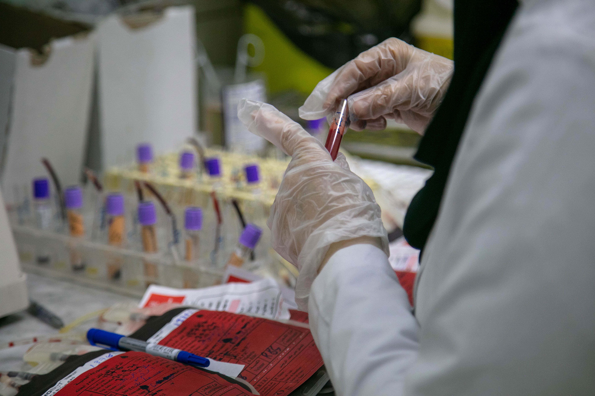 Blood samples being processed for testing. Credit: WHO Yemen/2025