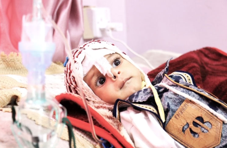Cholera and malnutrition in Yemen threatens millions