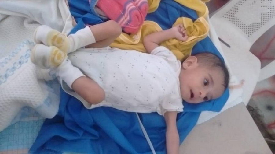 How WHO and KSrelief helped 7-month-old Samer recover from malnutrition